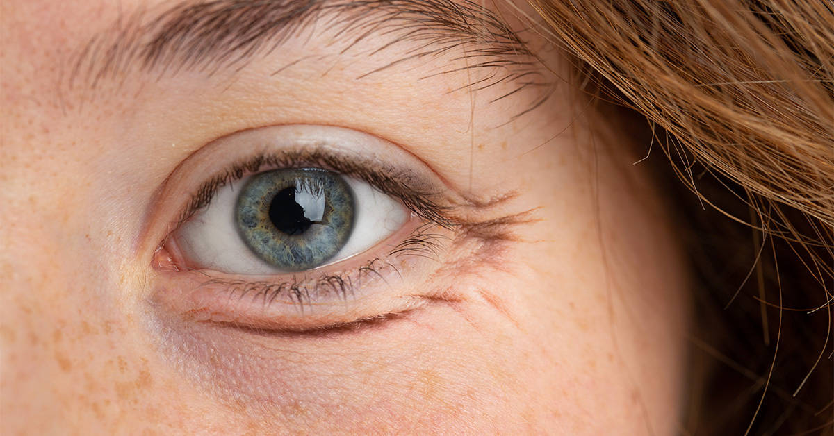 eye serums for dark circles